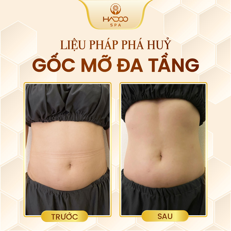 feedback-giam-beo-website-210822-1