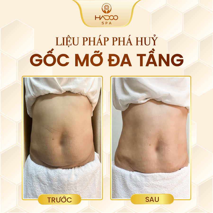 feedback-giam-beo-website-210822-2