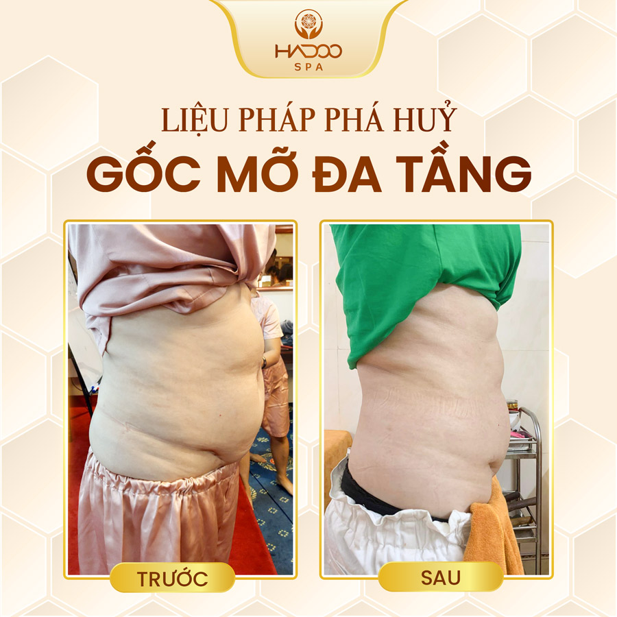 feedback-giam-beo-website-210822-3