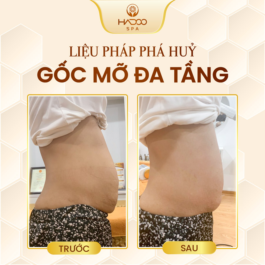 feedback-giam-beo-website-210822-4