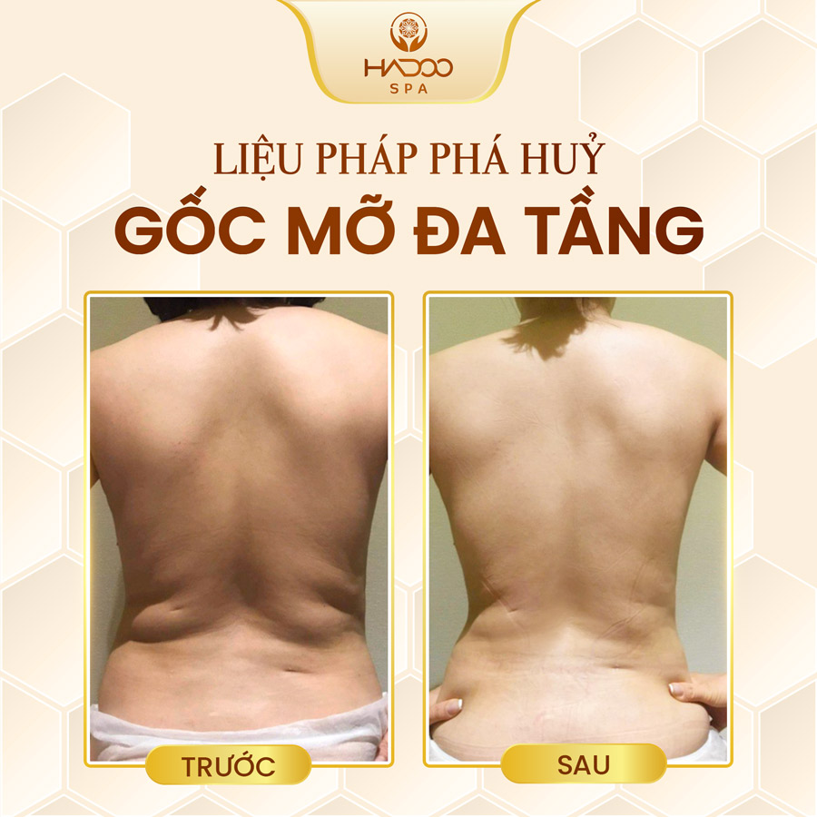 feedback-giam-beo-website-210822-5