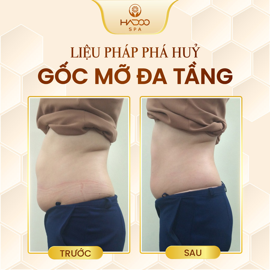 feedback-giam-beo-website-210822-6