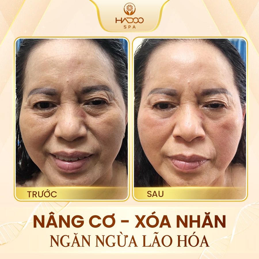 feedback-nang-co-website-210822-3